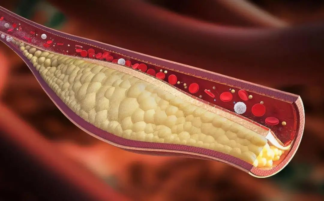 blood vessel scavenger